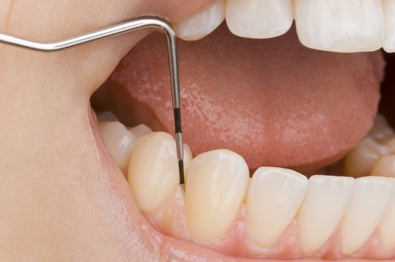 Parodontologija i oralna medicina